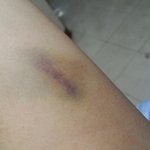 알바하고 돈 못받은 친동생 돈받으러 갔다가 폭행 <b>치사</b> 당한 이야기...