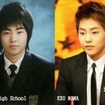 [EXO] 시우민 <b>턱</b> <b>필러</b> 맞았네