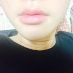 제입술 많이 두껍나요