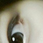 [댓글부탁] <b>눈지방</b>은 어뜨케 빼요?