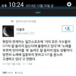 [EXO] 오늘 진짜 <b>병신</b>인가 보다