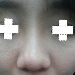 [피부<b>미용</b>] 이런 피부 어찌 관리 해야 되나요? 사진有