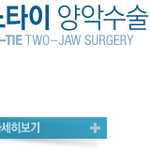 [EXO] 노타이 <b>양악</b>수술