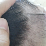 아기피부관리, 면역육아 팁 공유해요!