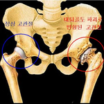 [EXO] <b>고관절</b>이 넓다고? 개소리 작작