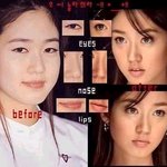 성유리 성형 햇을까영?