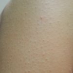 [EXO] ㅅㄷ)이거 <b>닭살</b> 심한 거 맞지