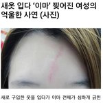 [틴펫이야기] 옷가게에서 새옷 입다 이마 찢어진 여성 ㄷㄷ
