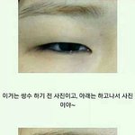 [EXO] 근데 <b>쌍수</b>이게 가능함?