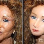 [허얼] [[충격]]<b>성형</b>부작용 여성의 기적