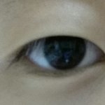 [댓글부탁] <b>눈지방</b> 많은거예요?