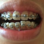 서면에 있는 최xx치과. 본인의 이를 생각한다면 가지마세요