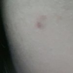 [EXO] 피부질문좀 ㅜㅜ