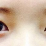 [눈<b>미간</b>평가] <b>미간</b>이 넓어요..