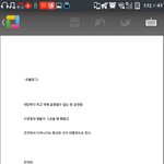 [EXO] <b>혼수</b>상태가 이거임?