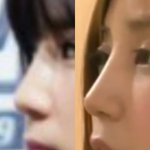[에이핑크] 초롱성형<b>오해</b>