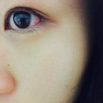 [도와주세요] 유명한 <b>원데이</b> 렌즈, 눈 안에서 쪼개졌어요