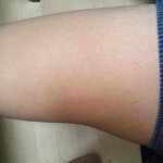 [꼭댓글부탁] 허벅지 코뿔소(혐)