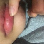 [댓글부탁] 내가 <b>입술</b>이 엄청 헐었는데..