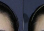 [EXO] 머리크기 작아진거냐?<b>경락</b> 후기에서퍼왔는데