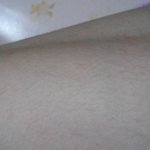 [EXO] 나 다리에 이런거있는데 뭐임?