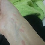 [EXO] 오늘 <b>닭가슴살</b> 치킨튀기다 기름 튐ㅠ