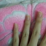 [EXO] 티켓팅때문에 깎은 내 <b>손톱</b>
