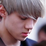 얼굴에 흉터 있는 남자 아이돌들