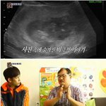 [추억파리여] 구급차 <b>길막</b>은 쏘3보다 더한ㅅㄲ