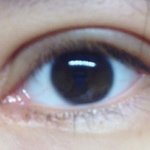 (사진ㅇ)<b>쌍수후</b> 라인두개