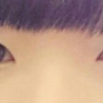 <b>쌍수</b>잘됬나요??ㅋㅋㅋ