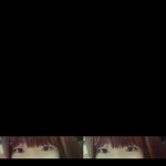 [꼭댓글부탁] 쌍수망한후기 사진안보여서다시올려요!!! (돈날렸어요걍;;)