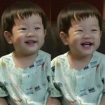 쌍수할까요?