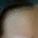 [조언부탁해] <b>이마</b>에 털이 너무 많아요ㅠㅠㅠㅠ