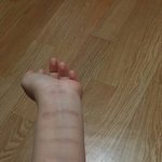[조언부탁] <b>팔목</b>에 자해 흔적 잠시 보이지 않게 하기 (사진 첨부)