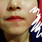 극혐주의) 이 피부 진짜 답없음
