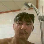 [EXO] <b>발치</b>해본애들 들어와봐