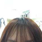쌍수햇는데...좀혐오지만...