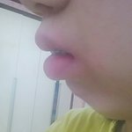 교정후기(<b>라지</b>만 사실 하소연)