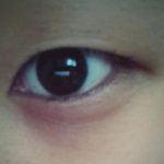 [해결방법] 눈늘어짐 <b>고민</b> +쌍수 <b>고민</b>