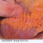 <b>부검</b>진실을 알고 싶어요