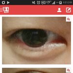 눈이 <b>존</b><b>못</b>이어서 <b>존</b>1나 슬퍼요 ㅜㅜ
