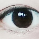 <b>속</b><b>쌍</b>인데 쌍수할까말까?ㅠㅠㅠ