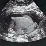 [EXO] 엑소팬질때 딱한번<b>울음</b>