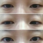 [꼭댓글조언] 쌍수 할까 말까너무 고민돼요 (사진있음)