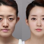 [EXO] 니네가 이 여자라면 <b>성형</b>할거냐?