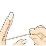 [EXO] 너네도 <b>여드름날때</b>