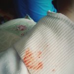 [EXO] 야 이거 어떡함?ㅅㅂ