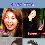 [모든팬덤] 연예계 대표적인 언<b>플로</b> 뜬 거품 성형미인~