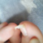 [EXO] 야 나<b>발톱</b> 어떡해